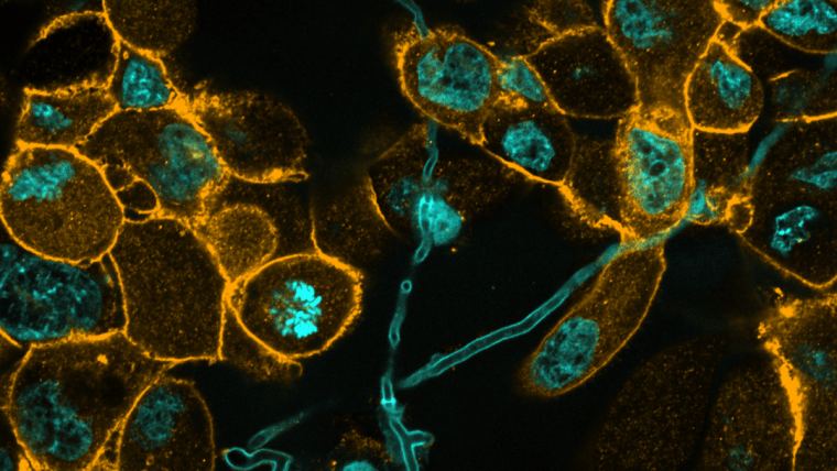 Microscopic image of fungal hyphae and human epithelial cells